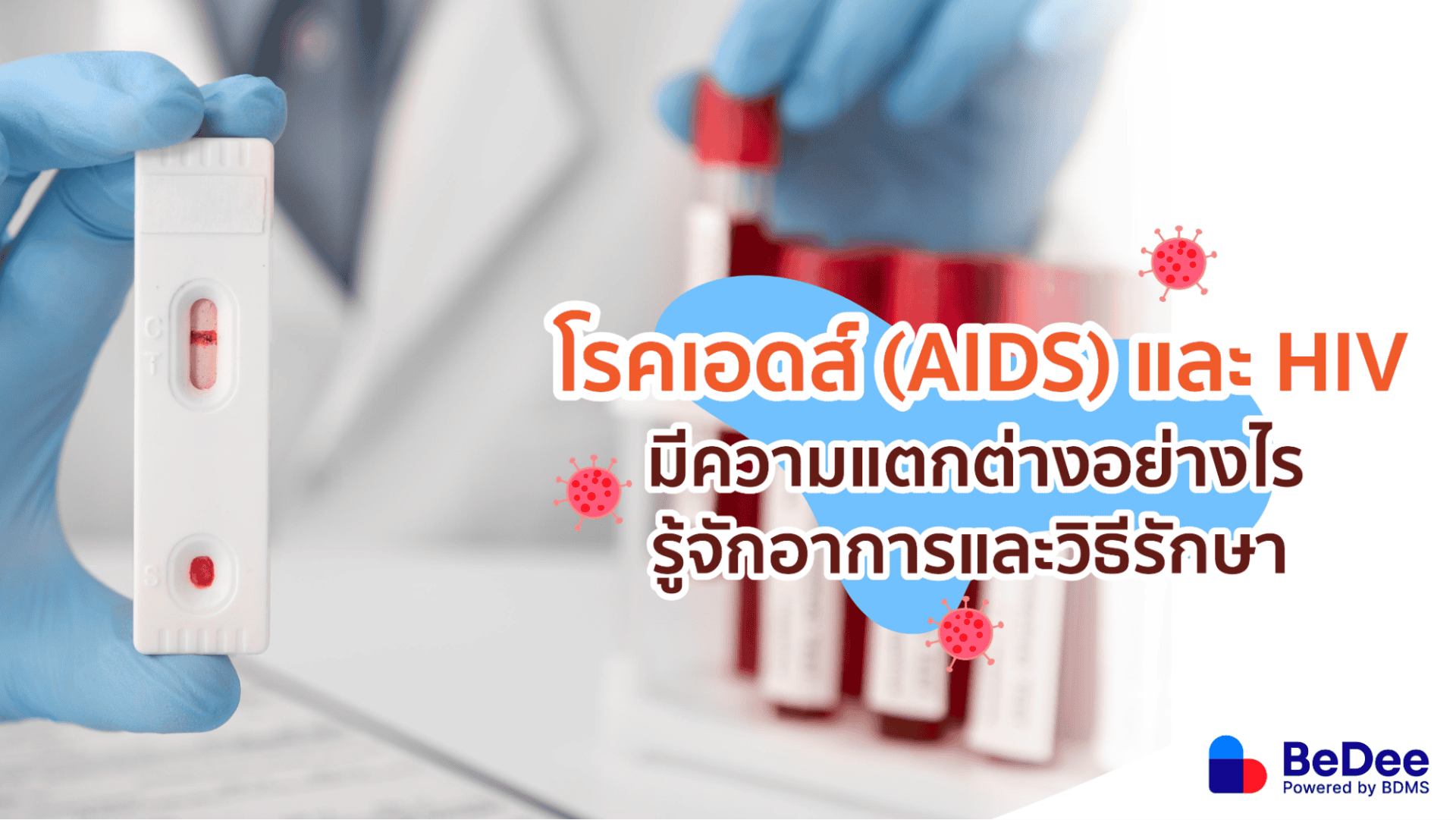 รู้จักโรคเอดส์ต่างกับโรคติดเชื้อไวรัส HIV อย่างไร วิธีรักษาและป้องกัน