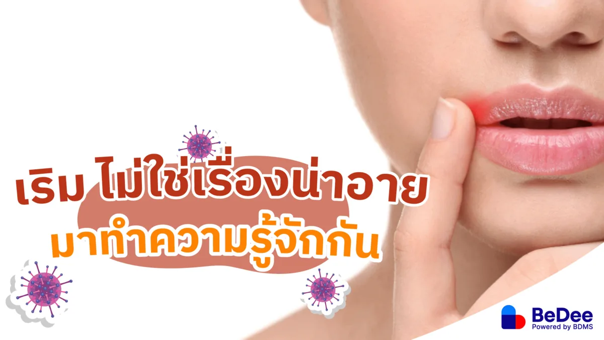 รวมทุกเรื่องเกี่ยวกับเริม โรคติดต่อที่ใครก็ไม่อยากเป็น