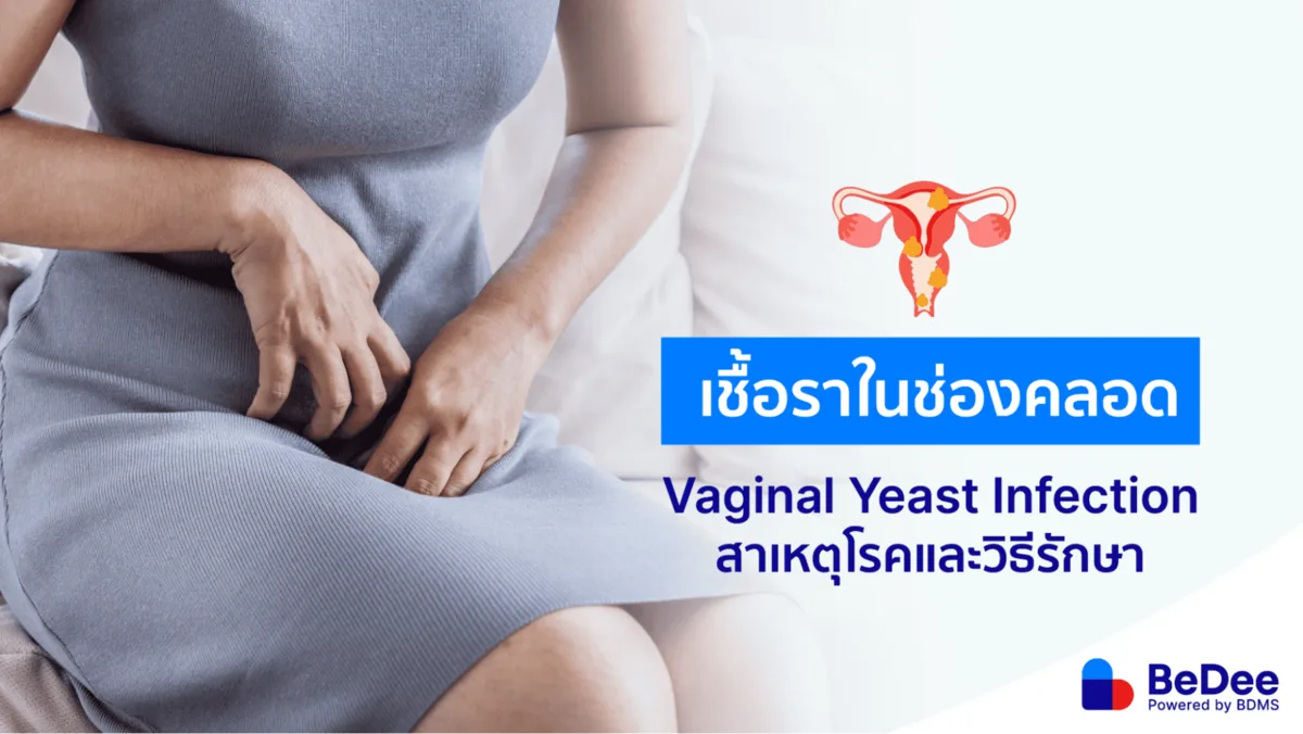เชื้อราในช่องคลอด แสบคันน้องสาว ตกขาวข้นหนืดต้องระวัง
