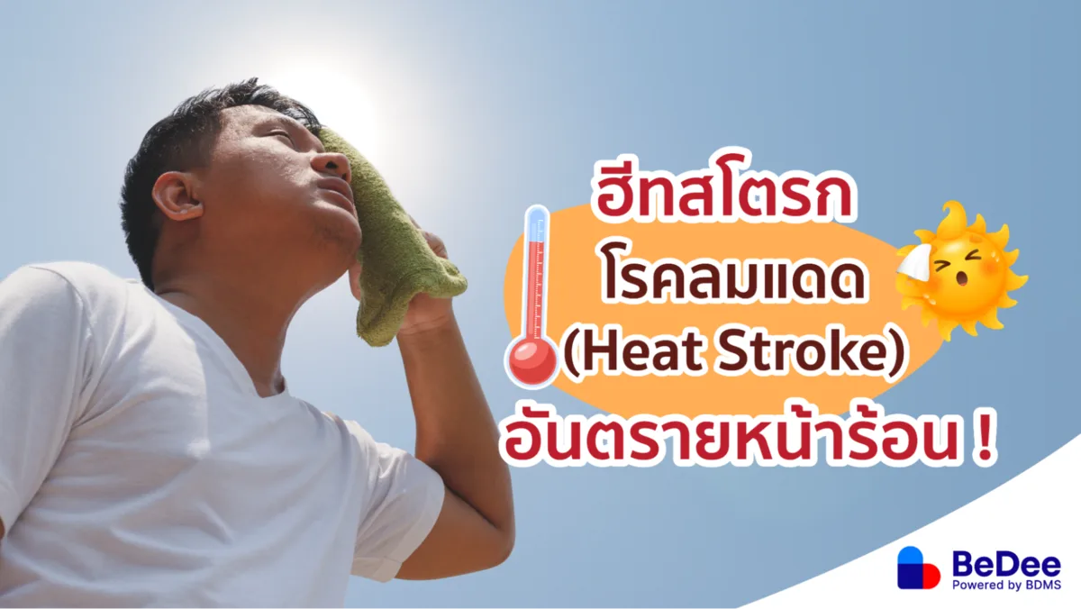 ฮีทสโตรก (Heat Stroke) โรคลมแดด อันตรายที่มาพร้อมฤดูร้อน