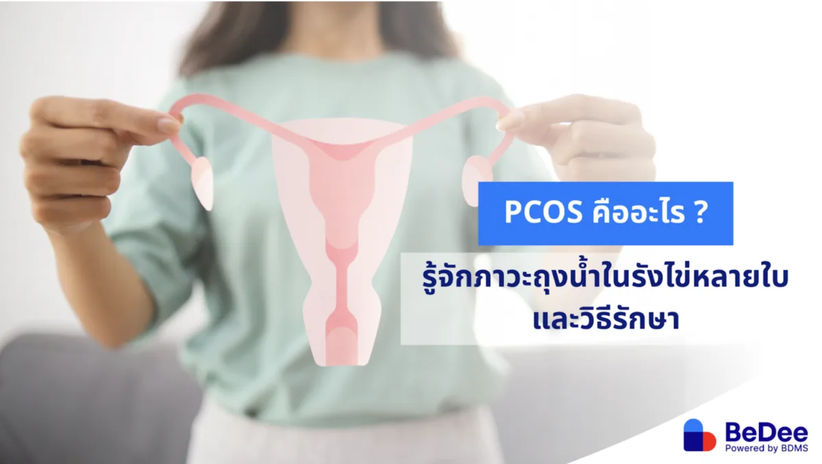 PCOS คืออะไร? รู้จักภาวะถุงน้ำในรังไข่หลายใบและวิธีรักษา