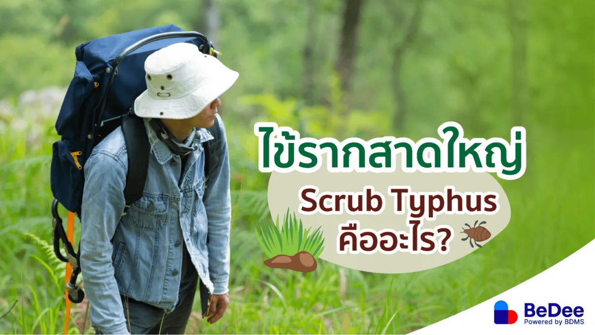 ไข้รากสาดใหญ่ (สครับไทฟัส) โรคที่มาจากตัวไรอ่อนกัด เข้าป่าต้องระวัง