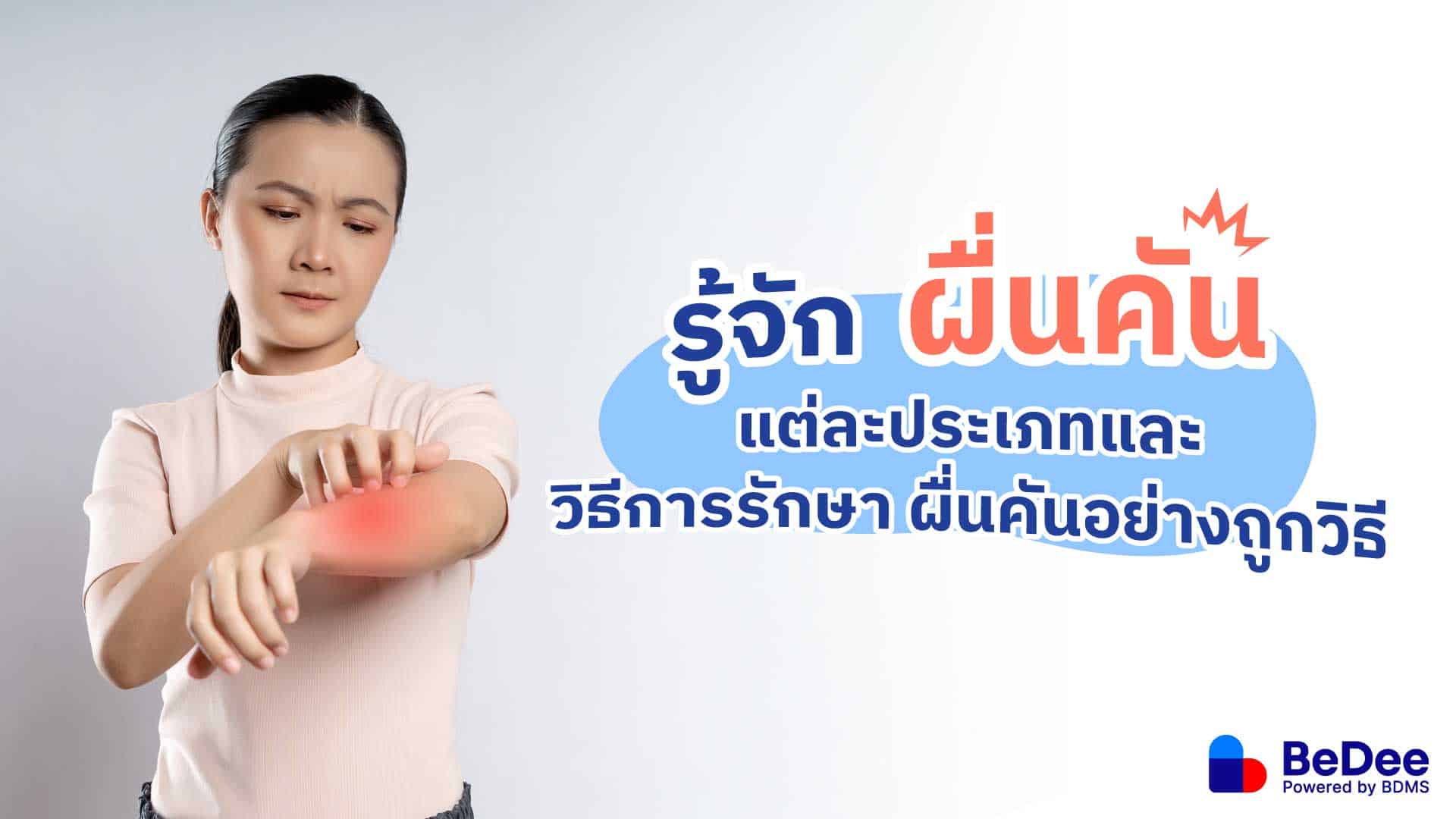 รู้จัก “ผื่นคัน” แต่ละประเภทและวิธีการรักษา ผื่นคันอย่างถูกวิธี