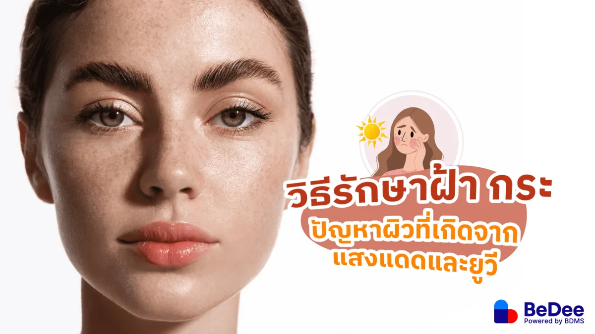วิธีรักษาฝ้า กระ ปัญหาผิวจากแสงแดดและยูวี