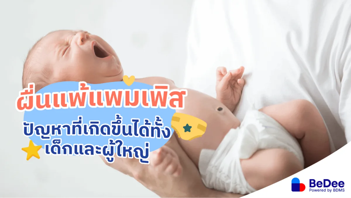 ผื่นแพ้แพมเพิส ปัญหาที่เกิดขึ้นได้ทั้งเด็กและผู้ใหญ่