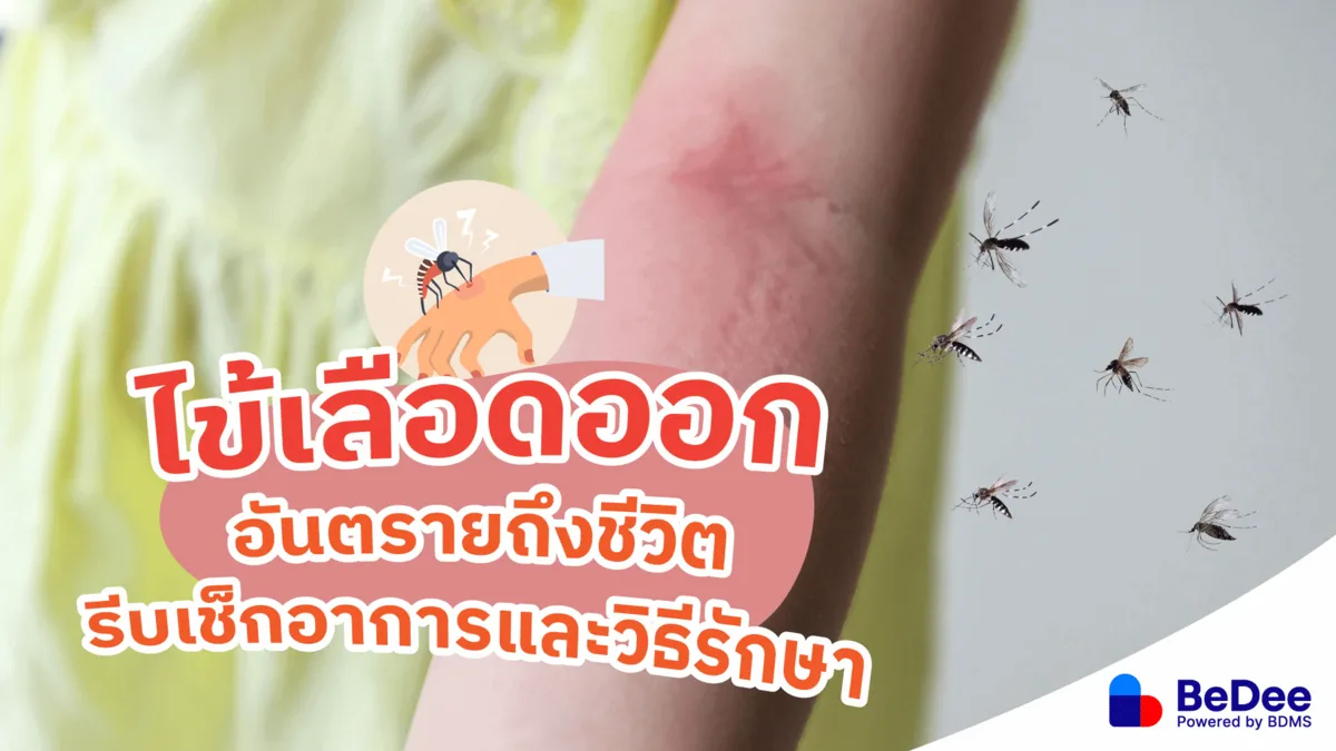 ไข้เลือดออกอันตรายถึงชีวิต รีบเช็กอาการและวิธีรักษา