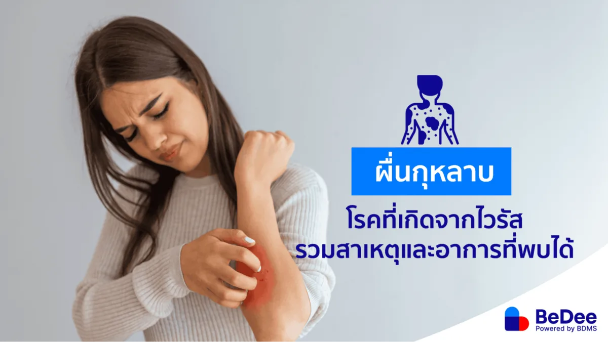 ผื่นกุหลาบ ผื่นขุยสีแดงที่พบได้ทั้งเด็กและผู้ใหญ่