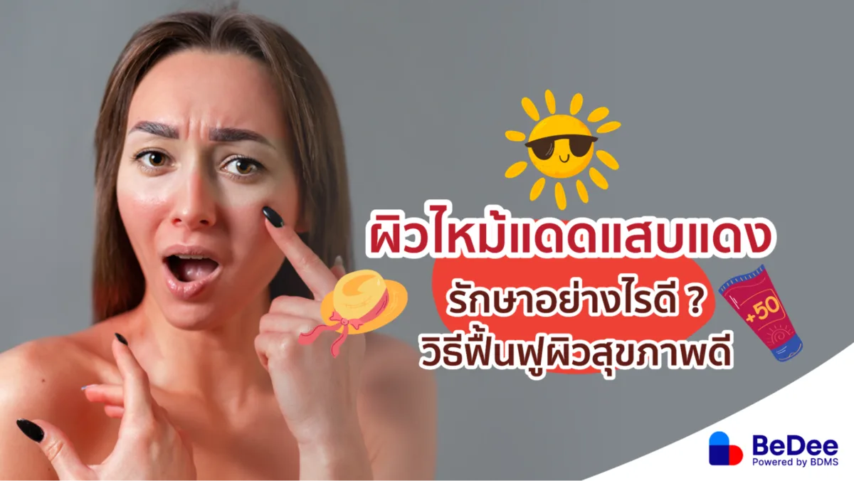 ผิวไหม้แดด ทำอย่างไรให้ผิวกลับมาสุขภาพดี