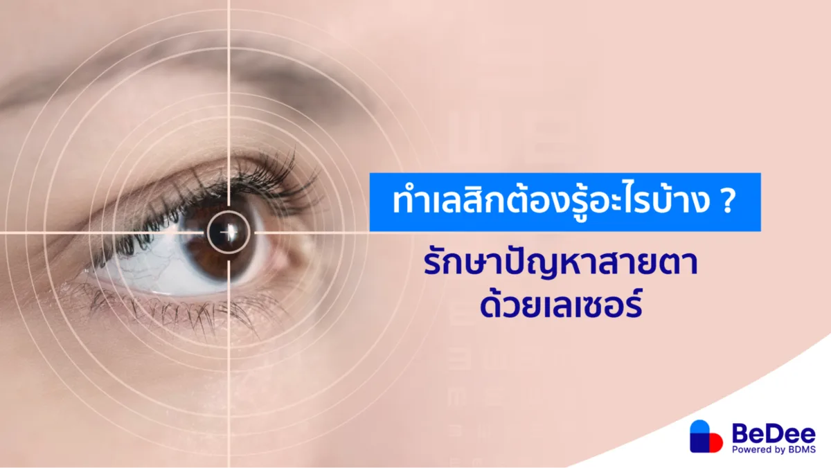 รวมเรื่องเลสิก แก้ปัญหาสายตา บอกลาแว่น