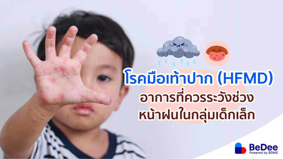 รู้จักโรคมือเท้าปากคืออะไร วิธีเฝ้าระวังเด็ก ๆ ในช่วงเปิดเทอม