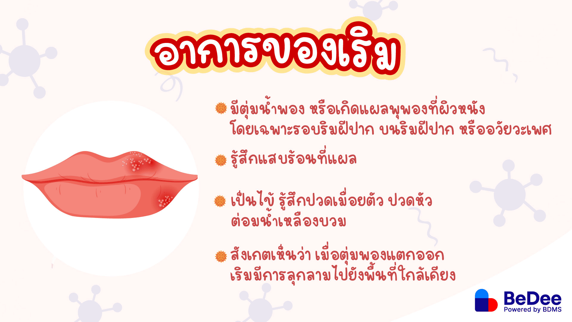 เริม อาการเริ่มต้น