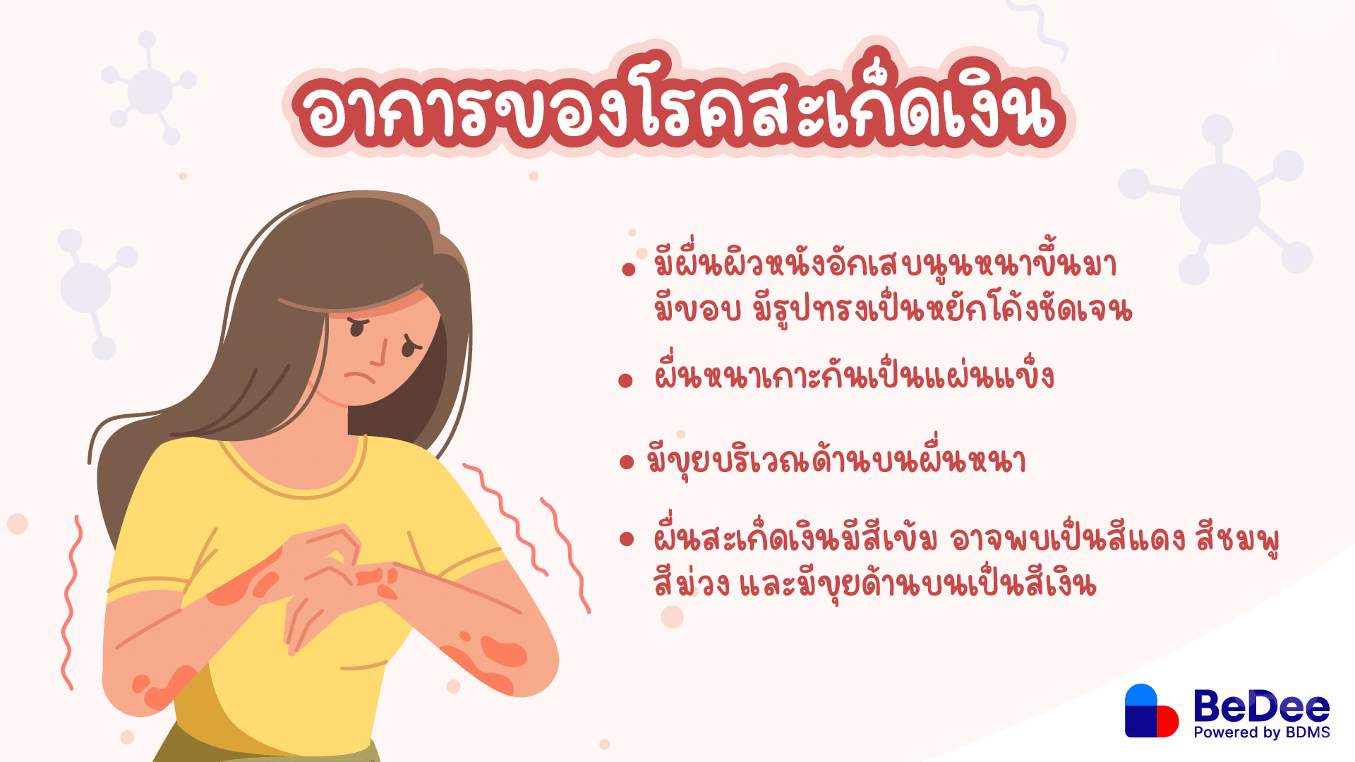 อาการของสะเก็ดเงิน