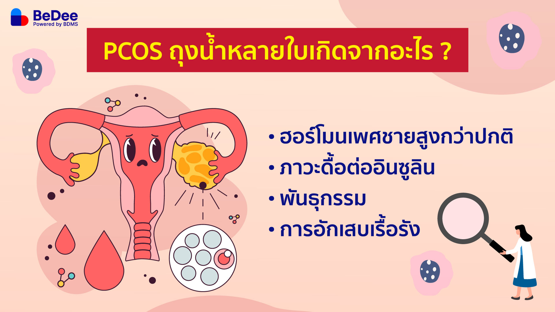 โรค PCOS เกิดจาก